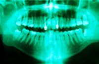 Andreea Moisiuc DDS